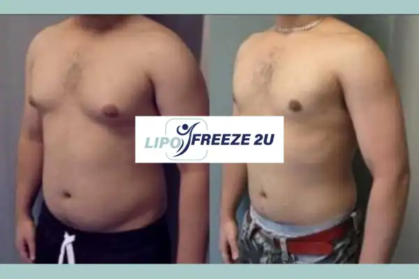 How Long Does It Take to See Results Horsham?
