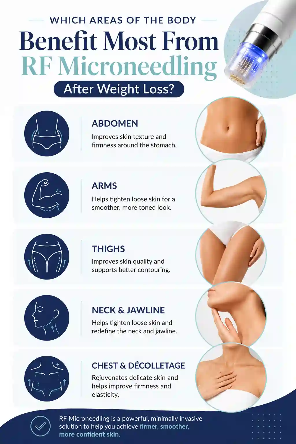 Which Areas of the Body Benefit Most From RF Microneedling After Weight Loss Horsham